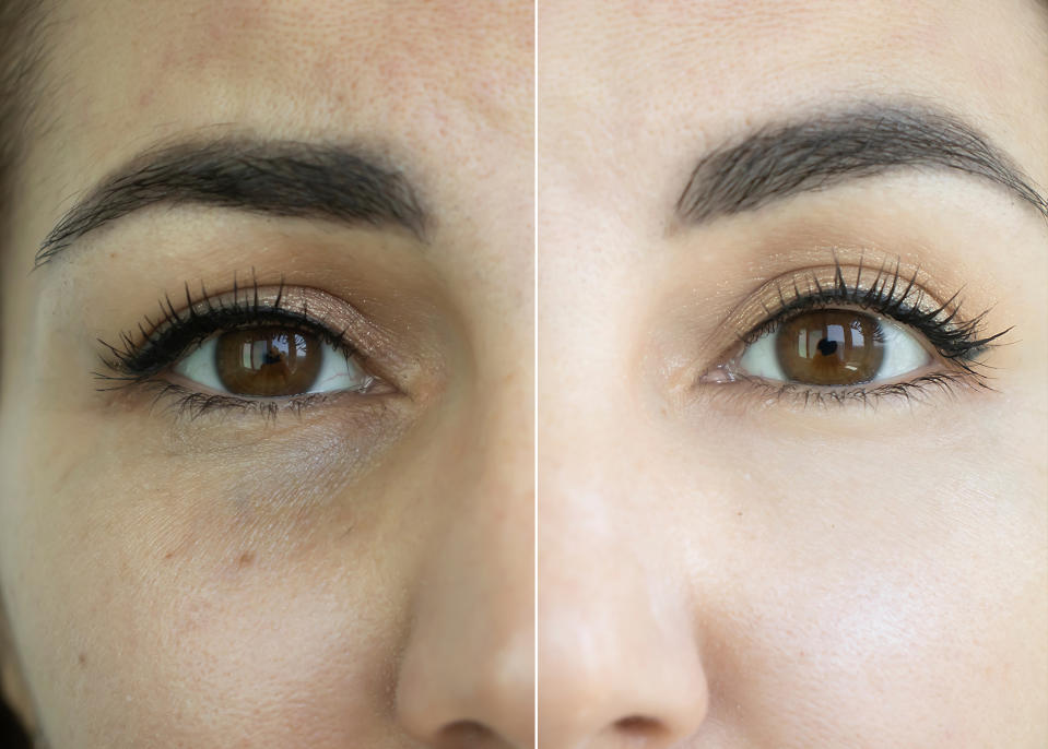 amazon-enaskin-naturals-eye-masks