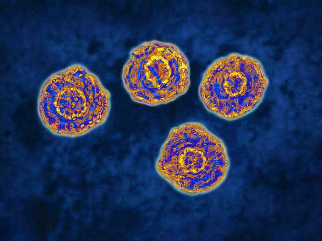 Hepatitis C can be cured.  So why aren't there more people getting treatment?