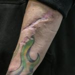 Tranq is becoming more common in the United States, and has been known to cause sores on the flesh, which may be the case here (ANGELA WEISS)