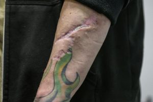 Tranq is becoming more common in the United States, and has been known to cause sores on the flesh, which may be the case here (ANGELA WEISS)